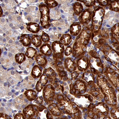 Hexokinase II Rabbit Polyclonal Antibody