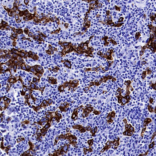 CK7/8 Recombinant Rabbit mAb (SDT-P006)