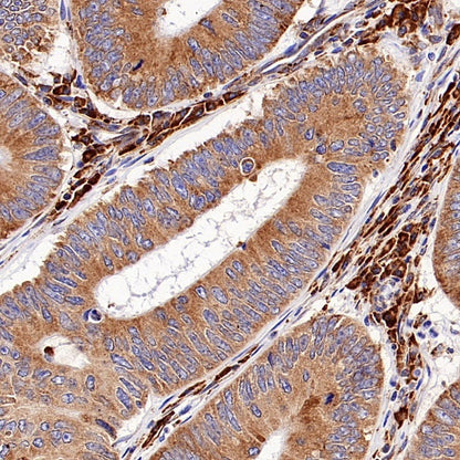 Cyclophilin B Recombinant Rabbit mAb (S-1543-63)