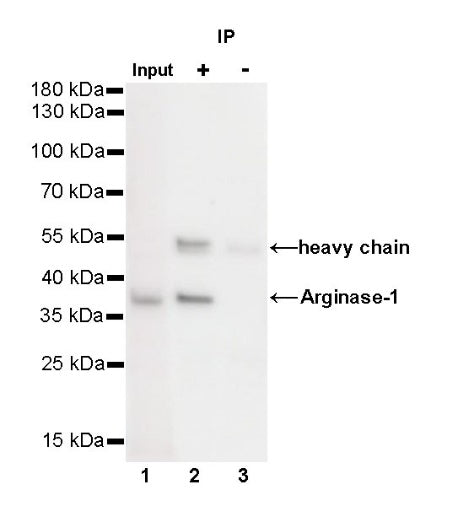 Arginase-1 Recombinant Rabbit mAb (SDT-369-33)