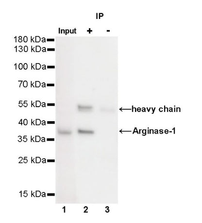 Arginase-1 Recombinant Rabbit mAb (SDT-369-33)