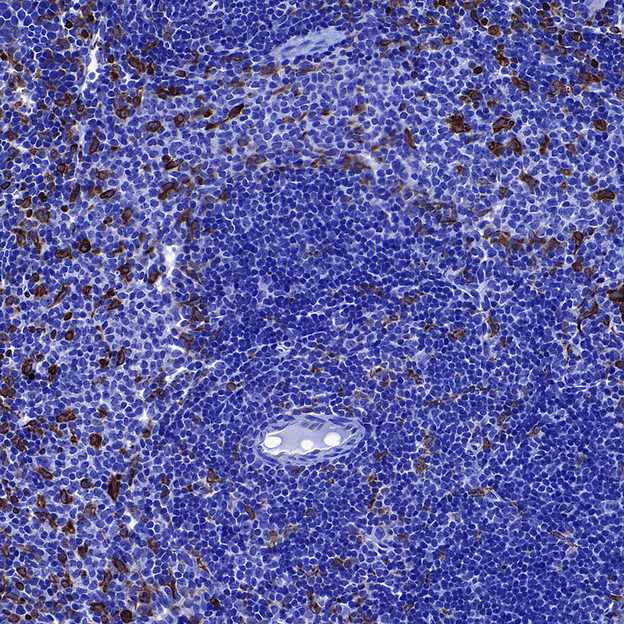 LPCAT2 Recombinant Rabbit mAb (S-4239-18)