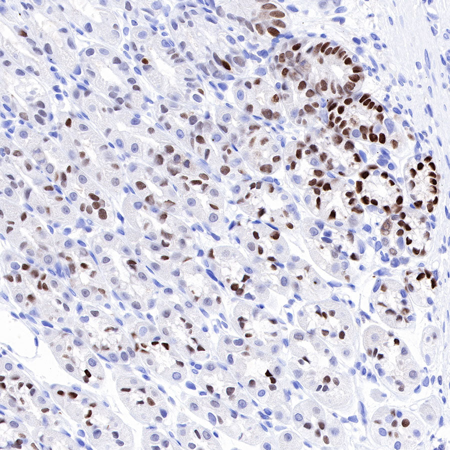 SOX9 Recombinant Rabbit mAb (SDT-019-29)