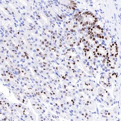 SOX9 Recombinant Rabbit mAb (SDT-019-29)