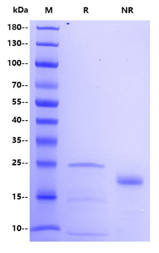 Human Trypsin 2 Protein, His tag