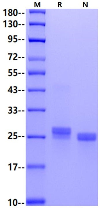 LCN2/NGAL His Tag Protein, Mouse