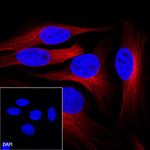 β-tubulin Recombinant Rabbit mAb (Alexa Fluor® 594 Conjugate) (S-312-113)