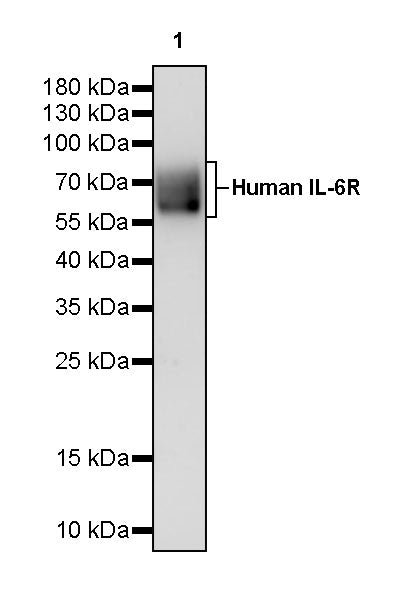 Anti-Human IL-6R Monoclonal Antibody (Tocilizumab)