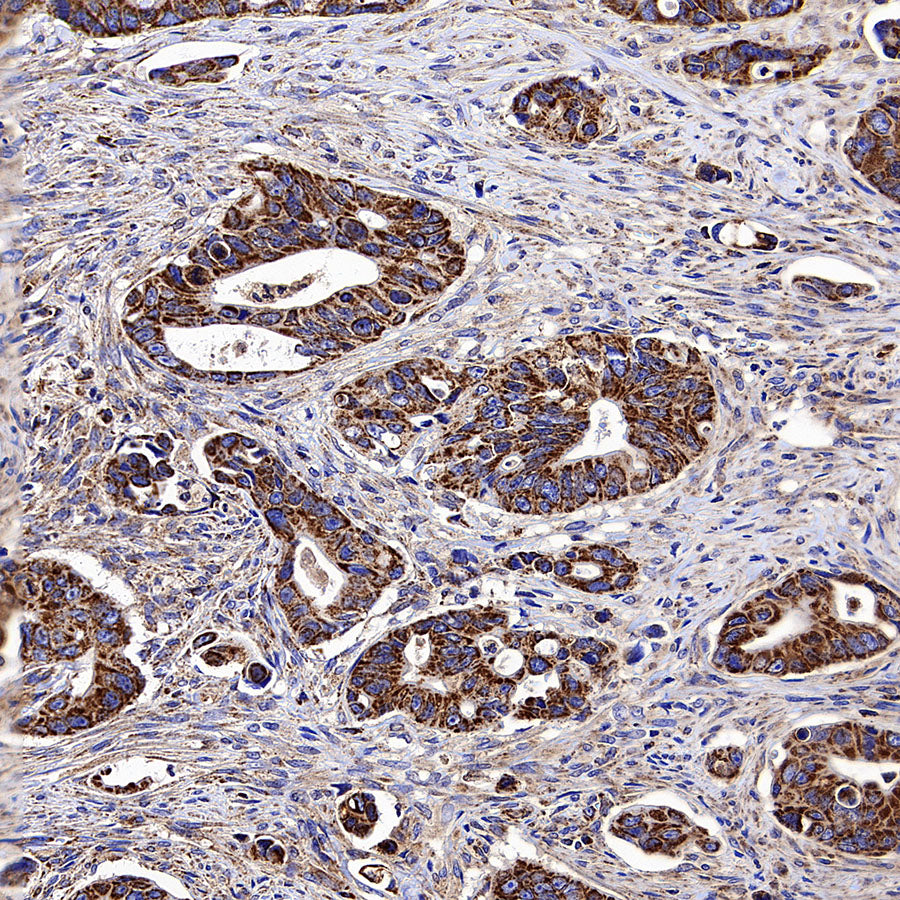 CLPP Recombinant Rabbit mAb (S-4169-31)