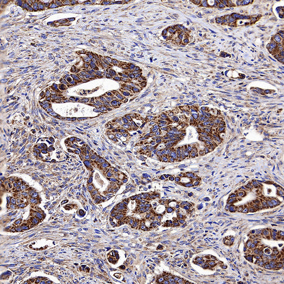 CLPP Recombinant Rabbit mAb (S-4169-31)