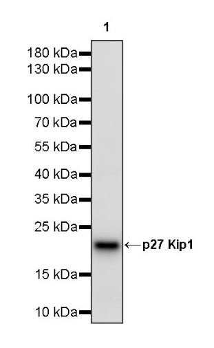 p27 Kip1 Recombinant Rabbit mAb (SDT-361-310)