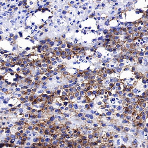 CD56 Recombinant Rabbit mAb (SDT-5000)