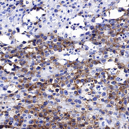 CD56 Recombinant Rabbit mAb (SDT-5000)