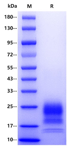 Mouse BST2 Protein, His tag