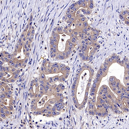 c-IAP2 Recombinant Rabbit mAb (S-3395)