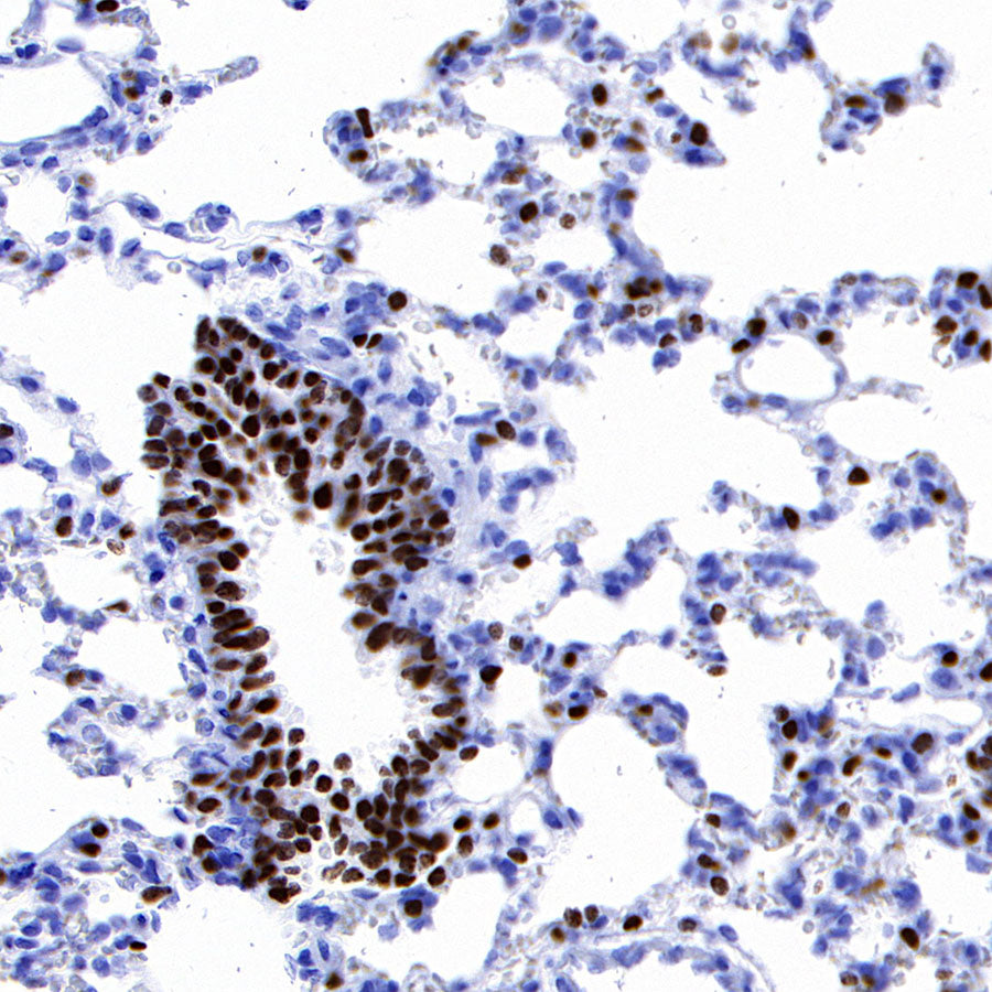 FOXA2 Recombinant Rabbit mAb (SDT-R174)