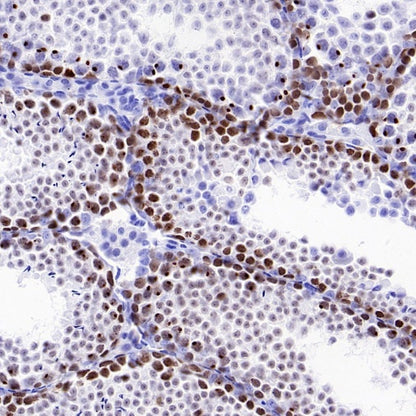 ETD Recombinant Rabbit mAb (S-3661-43)