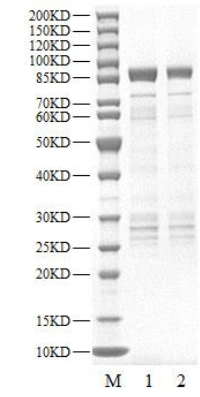 DYRK4 GST Tag Protein, Human