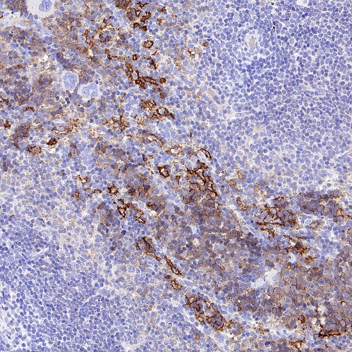 SLC40A1/Ferroportin Recombinant Rabbit mAb (S-2172-35)