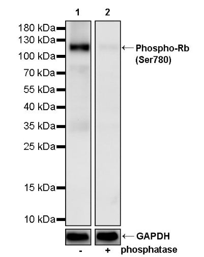 Phospho-Rb (Ser780) Recombinant Mouse mAb (S-3521)