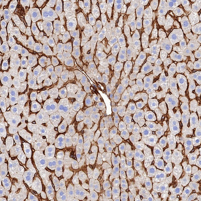 HLA-E Recombinant Rabbit mAb (S-1081-62)