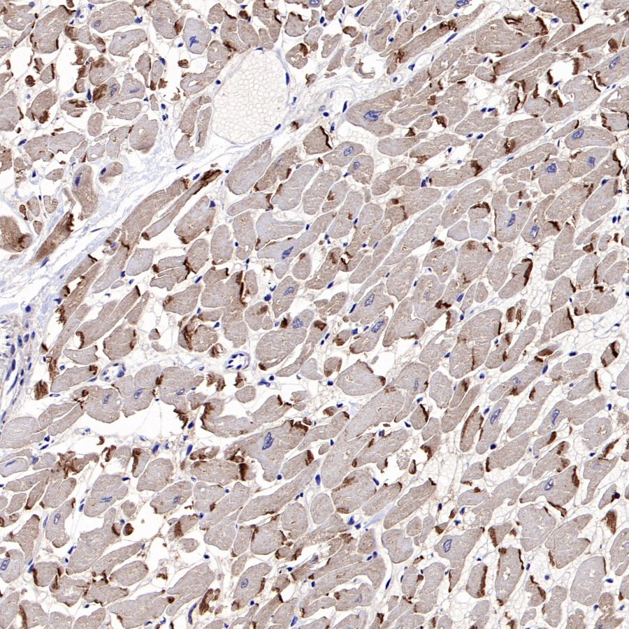 Desmocollin-2/3(DSC2/3) Recombinant Rabbit mAb (SDT-2102-59)
