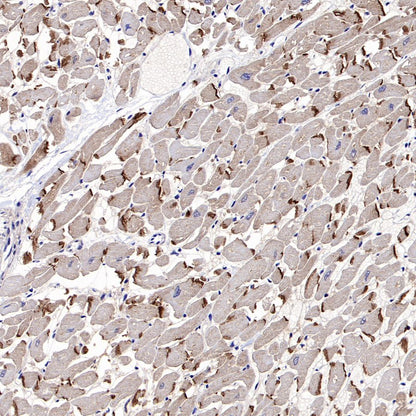 Desmocollin-2/3(DSC2/3) Recombinant Rabbit mAb (SDT-2102-59)