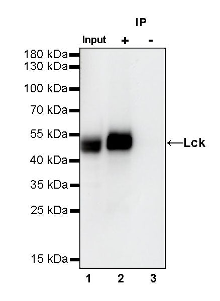 Lck Recombinant Rabbit mAb (SDT-316-15)
