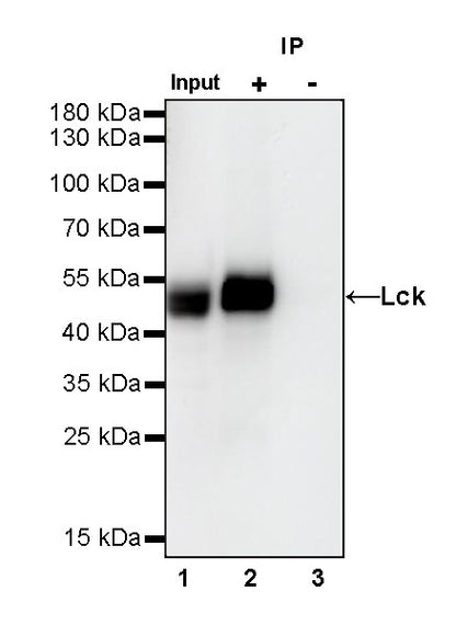 Lck Recombinant Rabbit mAb (SDT-316-15)