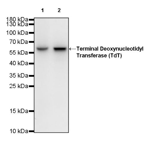 Terminal Deoxynucleotidyl Transferase (TdT) Recombinant Rabbit mAb (S-R245)