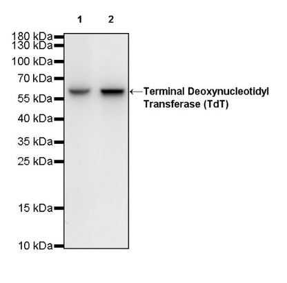 Terminal Deoxynucleotidyl Transferase (TdT) Recombinant Rabbit mAb (S-R245)