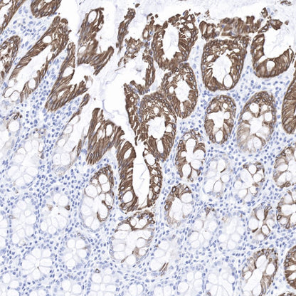 Keratin 20 Recombinant Rabbit mAb (SDT-013-18)