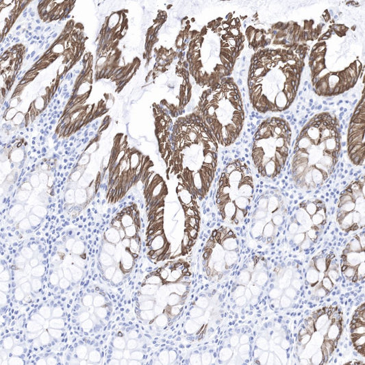Keratin 20 Recombinant Rabbit mAb (SDT-013-18)