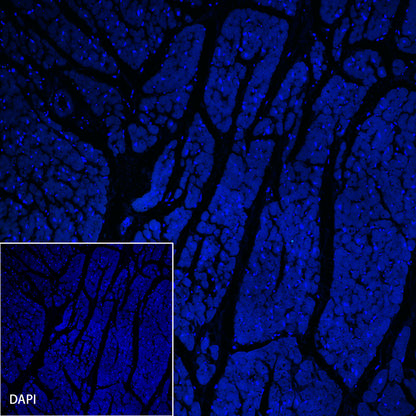 ACTH Recombinant Rabbit mAb (SDT-363-60)