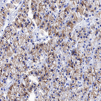 BSND Recombinant Rabbit mAb (S-3815-70)