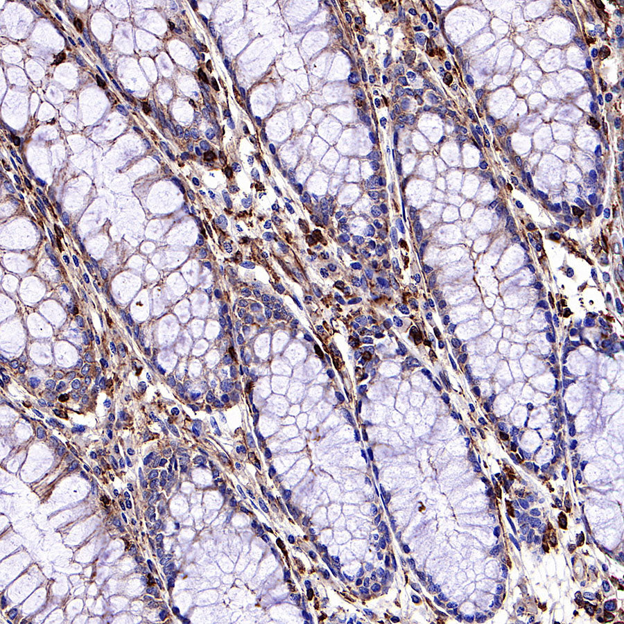β-actin Recombinant Rabbit mAb (SDT-R156)