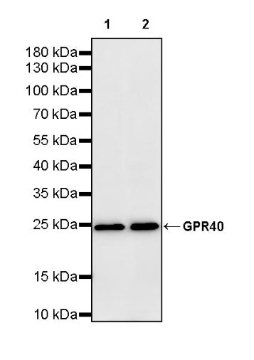 GPR40 Recombinant Rabbit mAb (S-3817-50)
