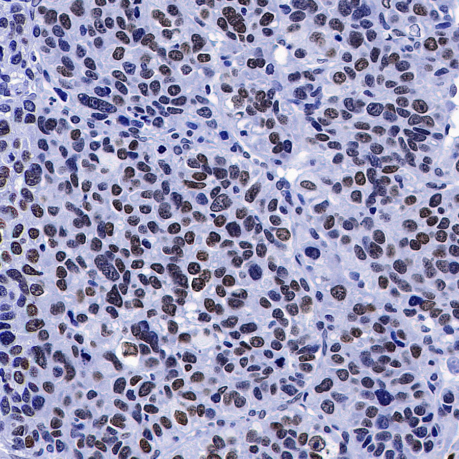 Histone H3 Recombinant Rabbit mAb (S-5672)