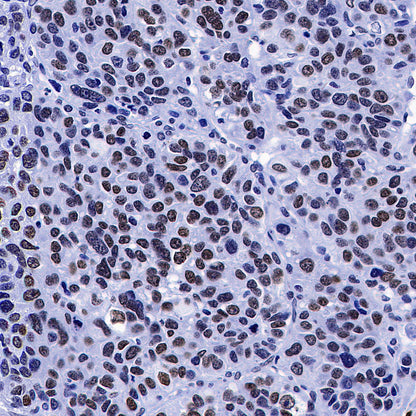 Histone H3 Recombinant Rabbit mAb (S-5672)