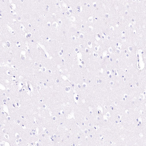 CD48 Recombinant Rabbit mAb (S-R265)