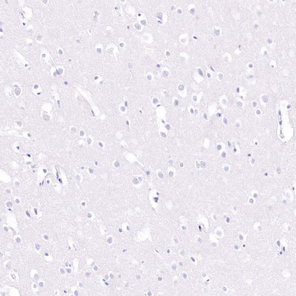 CD48 Recombinant Rabbit mAb (S-R265)