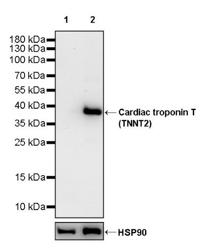 Cardiac troponin T (TNNT2) Recombinant Rabbit mAb (SDT-2894-34)