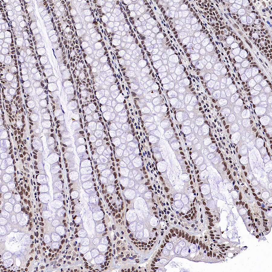 L-Lactyl Lysine Rabbit mAb