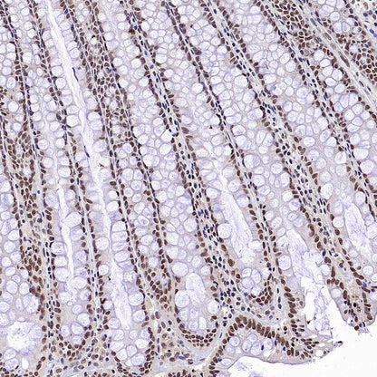 L-Lactyl Lysine Rabbit mAb