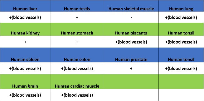 Angiotensin Converting Enzyme 1 Recombinant Rabbit mAb (SDT-2662-122)
