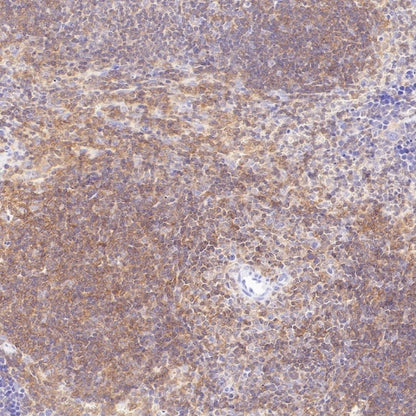 CD100/Semaphorin-4D Recombinant Rabbit mAb (S-3651-16)