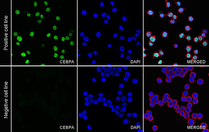 CEBPA Recombinant Rabbit mAb (S-3629-33)