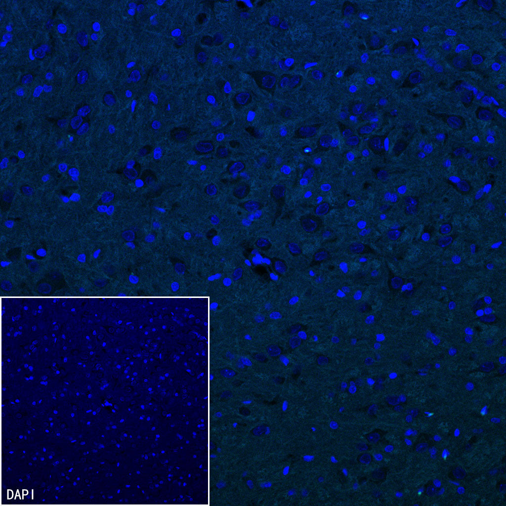 Olfactory Marker/OMP Recombinant Rabbit mAb (S-3513-32)