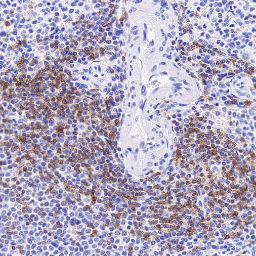 CD6 Recombinant Rabbit mAb (S-1512-39)