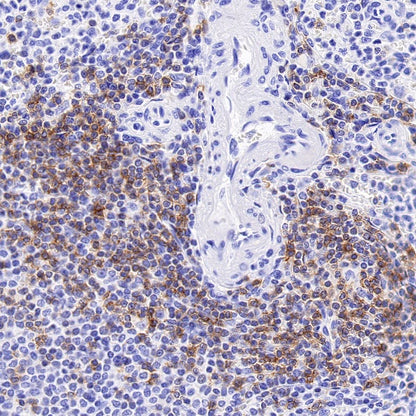 CD6 Recombinant Rabbit mAb (S-1512-39)
